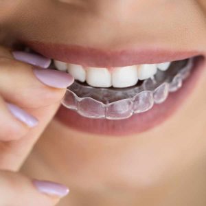 custom mouth guard