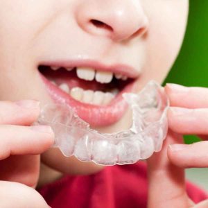mouth guard