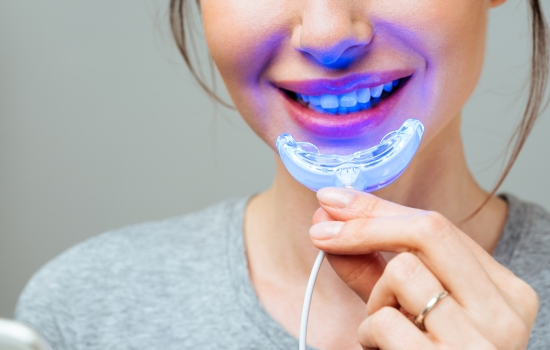 teeth whitening perth price