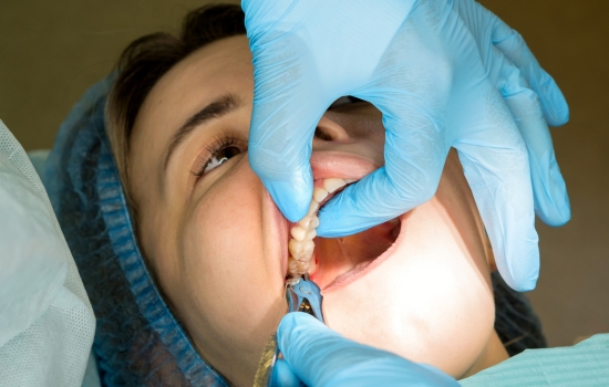 wisdom teeth removal cost perth