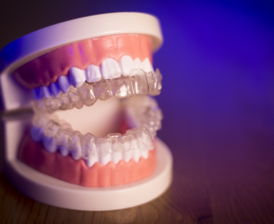 avoiding common denture issues