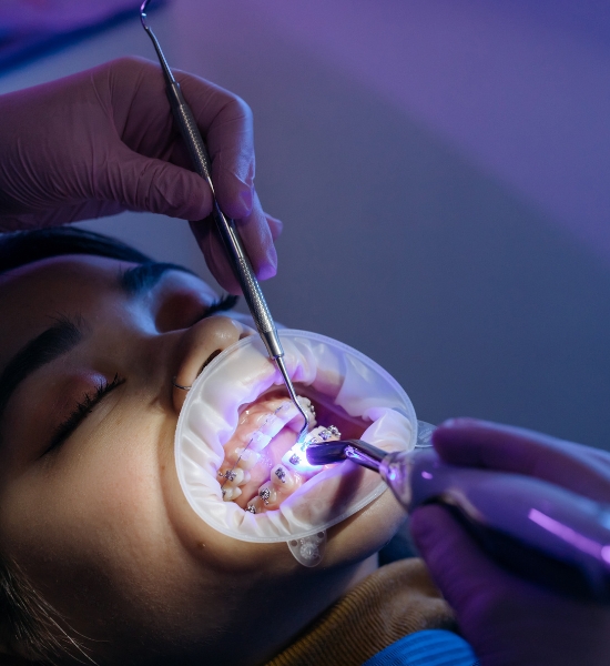 best dentists perth for micro abrasion