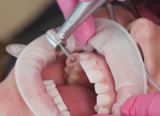 wanneroo dentist