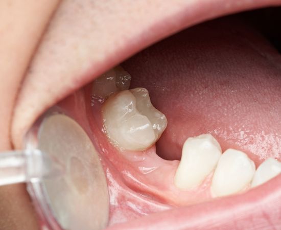 dentist perth
