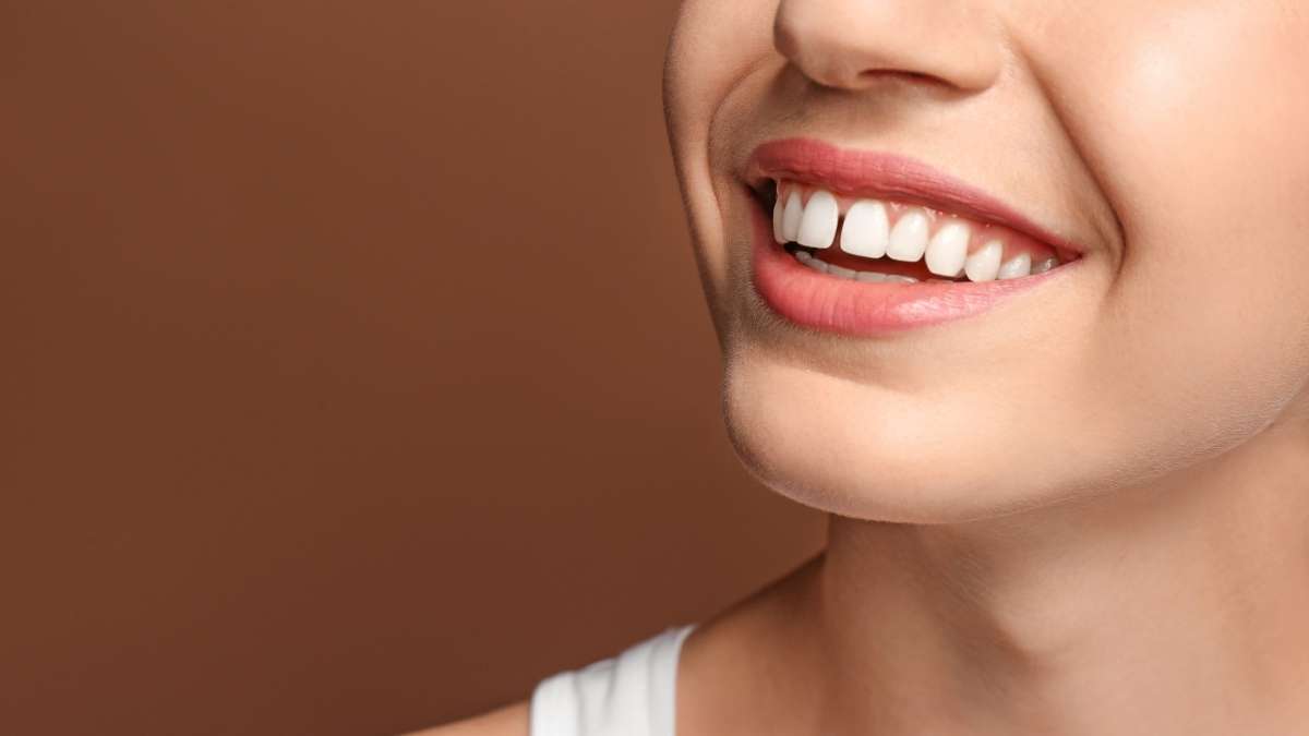 gappy teeth