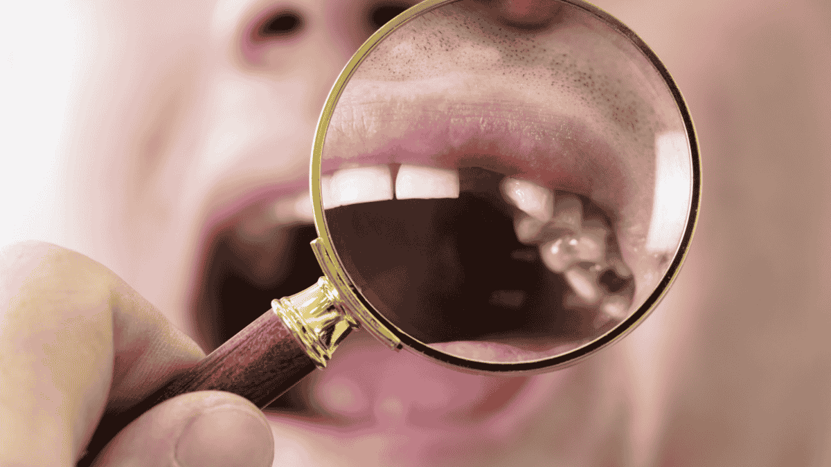 dental replacement options