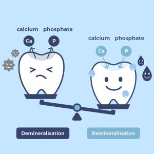 remineralizing toothpaste