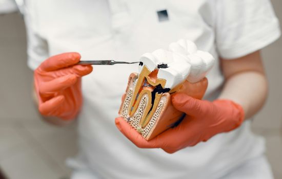 chipped tooth repair price