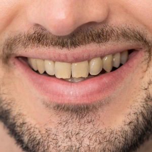 enamel repair toothpaste