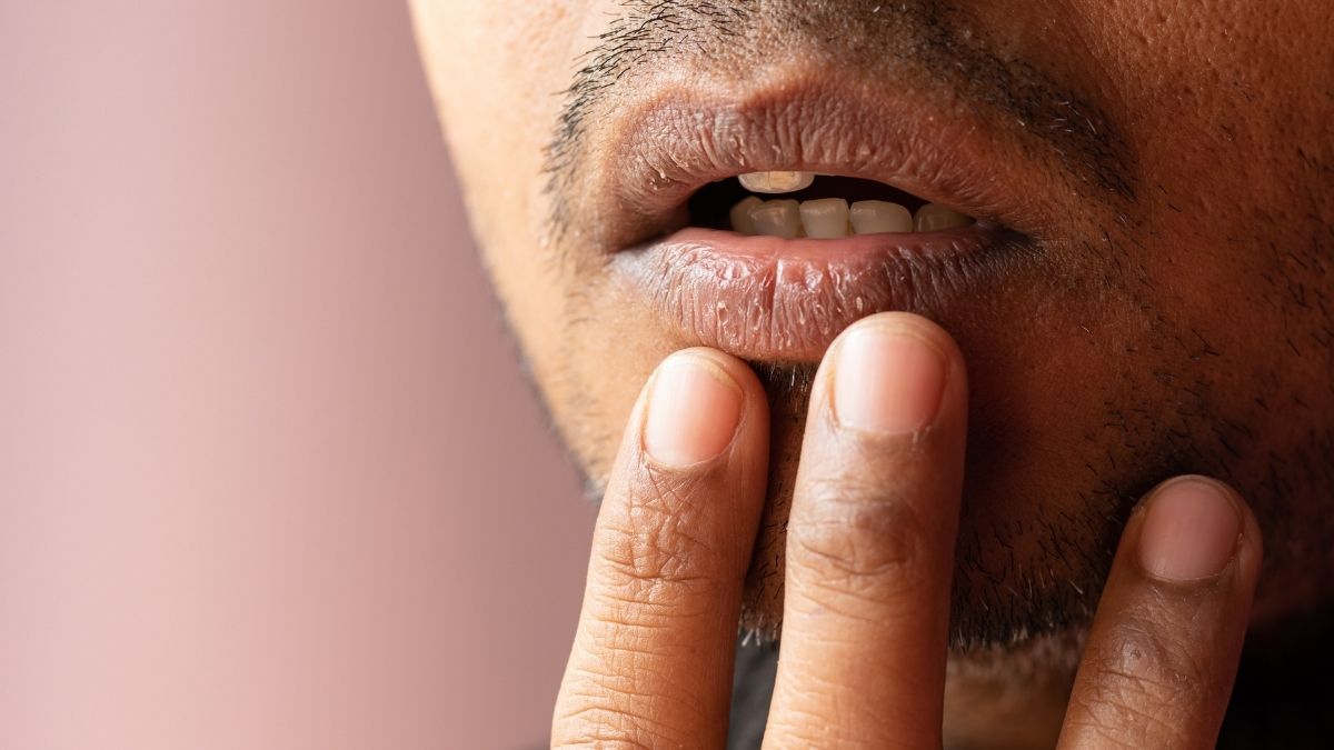 dry mouth