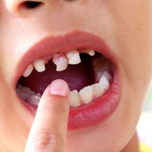 dentist for kids