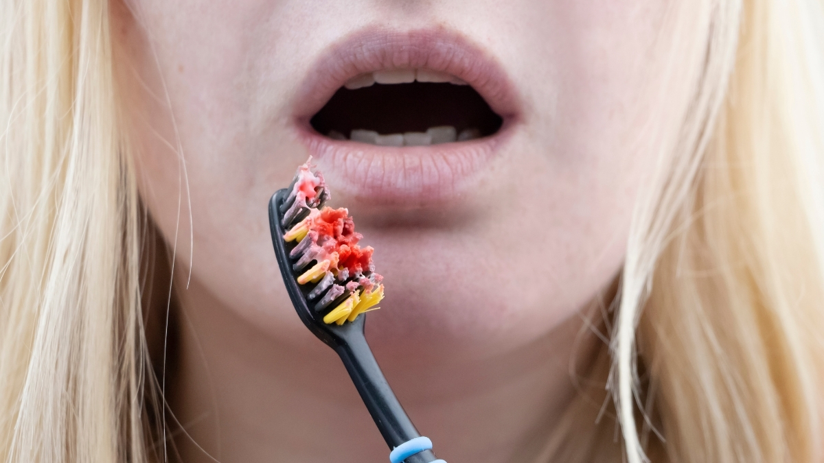 brushing teeth and gums bleed