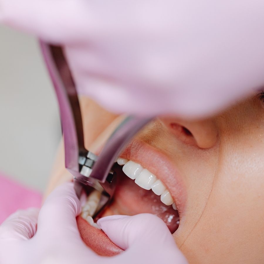 surrounding teeth hurt after tooth extraction