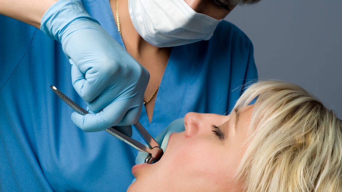 Empty Extraction Socket Radiograph Healthy Socket After Tooth Extraction : Gentle Dental Centre