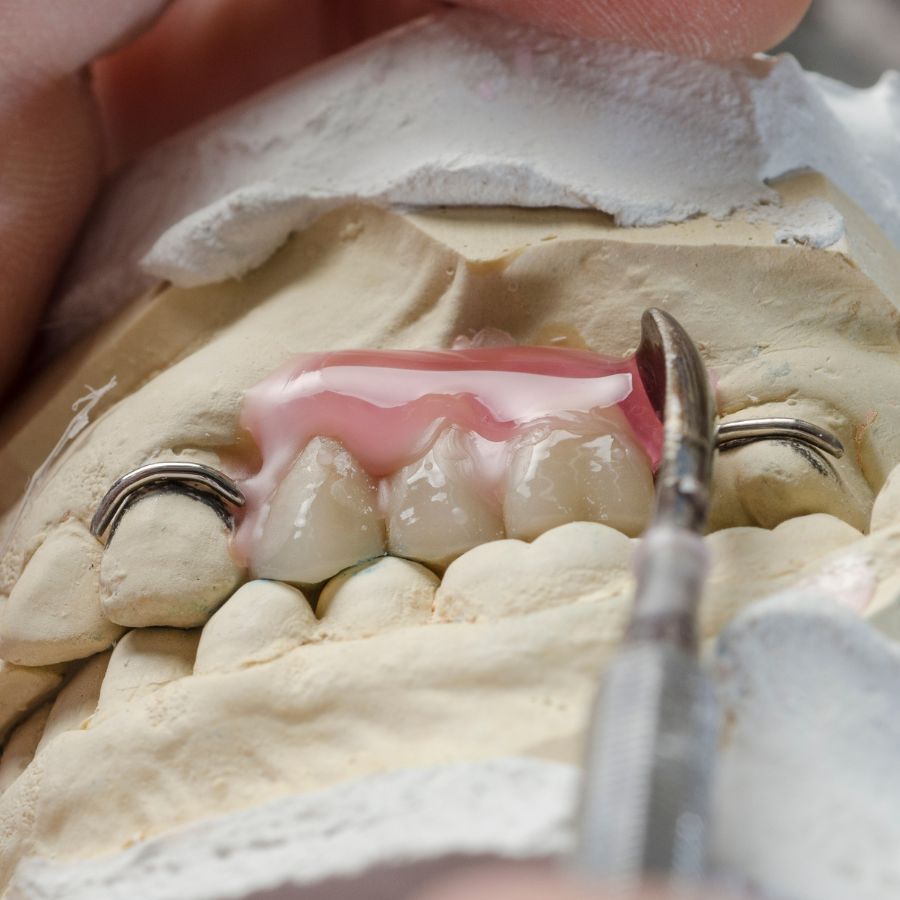 partial dentures